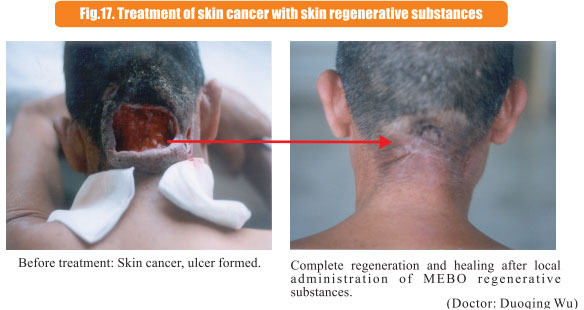9170金沙集团_8  Research on rResearch on regenerative anti-cancer