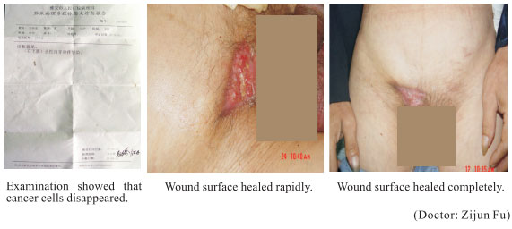 9170金沙集团_8  Research on rResearch on regenerative anti-cancer