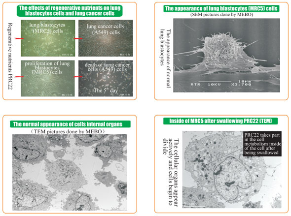 9170金沙集团_8  Research on rResearch on regenerative anti-cancer