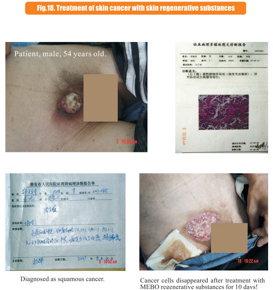 9170金沙集团_8  Research on rResearch on regenerative anti-cancer