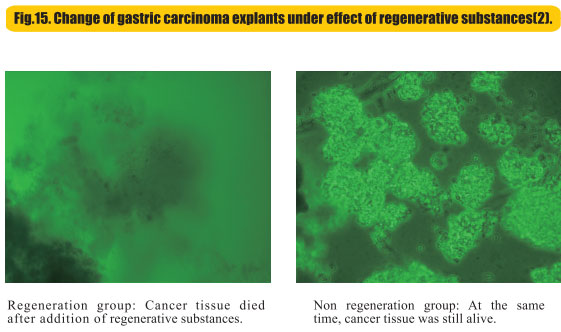 9170金沙集团_8  Research on rResearch on regenerative anti-cancer