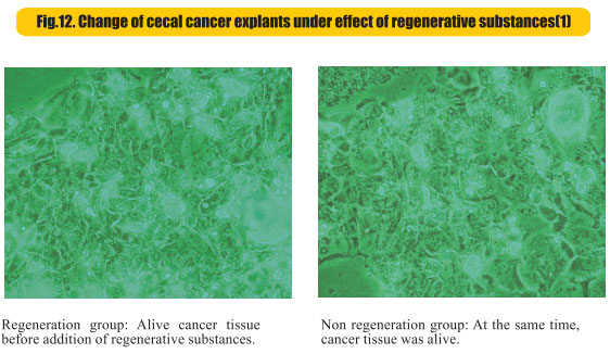 9170金沙集团_8  Research on rResearch on regenerative anti-cancer
