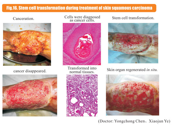 9170金沙集团_8  Research on rResearch on regenerative anti-cancer