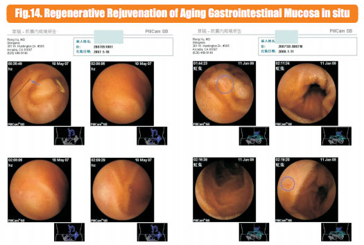 9170金沙集团_6  In situ regenerative restoration of gastrointestinal muco