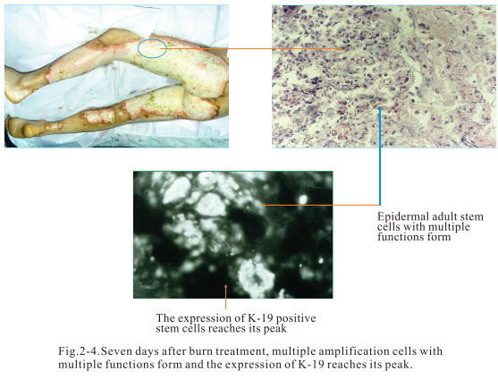 9170金沙集团_2. Period of deciphering the secret of somatic cells being i