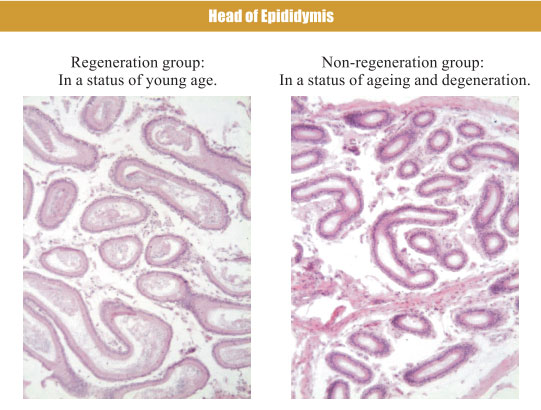 9170金沙集团_4. Period of regenerative restoration of animal tissues and