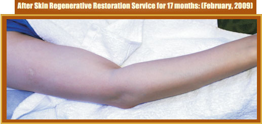 9170金沙集团_Part Two: Examples of in situ Skin Regenerative Restoration