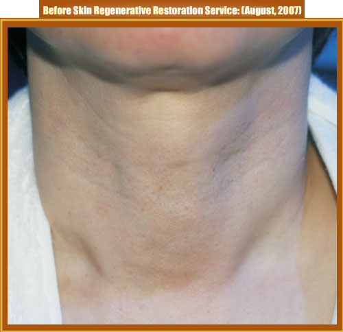 9170金沙集团_Part Two: Examples of in situ Skin Regenerative Restoration