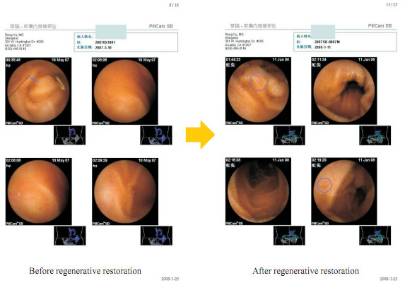 9170金沙集团_How is an aged cell regenerated?