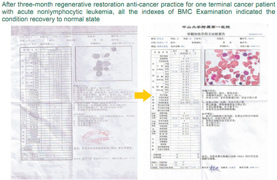 9170金沙集团_The mystery of cancer and the relation between cancer and re