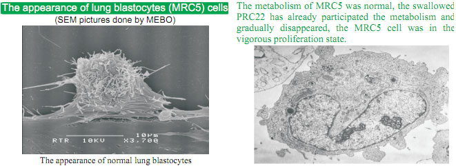 9170金沙集团_The mystery of cancer and the relation between cancer and re