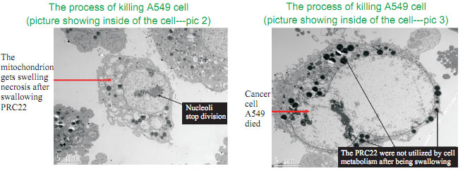 9170金沙集团_The mystery of cancer and the relation between cancer and re