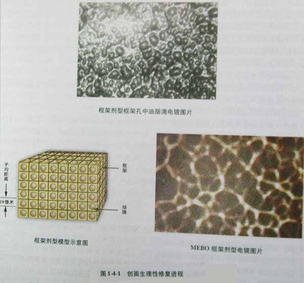 9170金沙集团_第一节 湿润烧伤膏的研制与药效作用