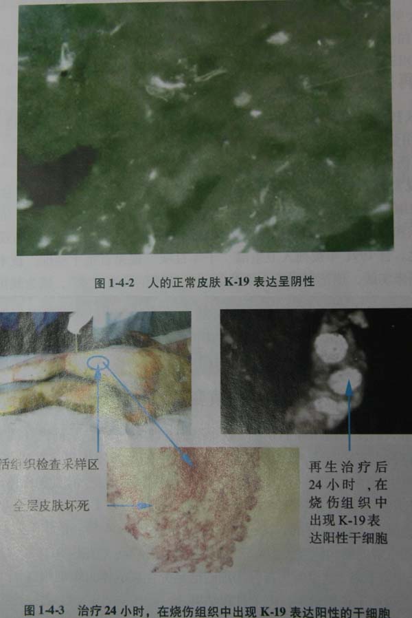 9170金沙集团_第二节 四肢热挤压伤治疗手艺