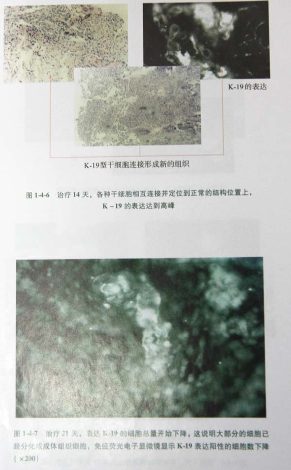 9170金沙集团_第二节 四肢热挤压伤治疗手艺