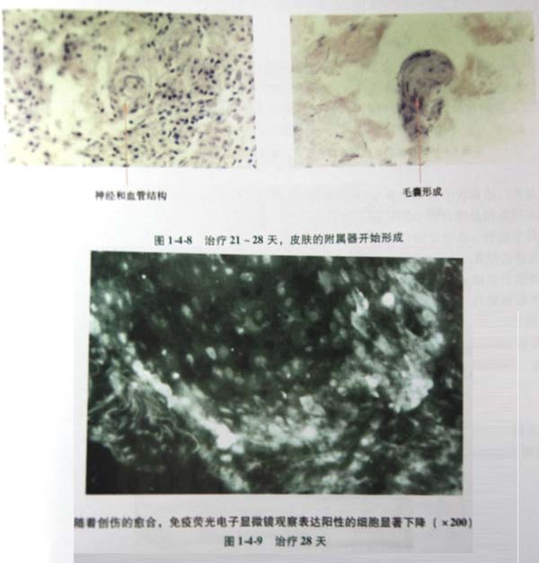 9170金沙集团_第二节 四肢热挤压伤治疗手艺