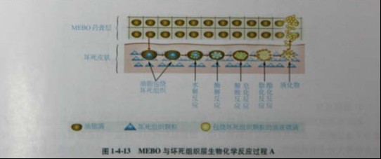 9170金沙集团_第三节 烧伤创面坏死组织液化扫除与实验要领