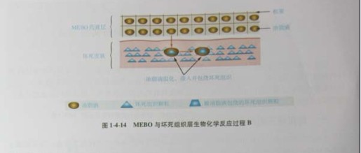 9170金沙集团_第三节 烧伤创面坏死组织液化扫除与实验要领