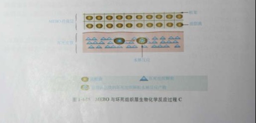 9170金沙集团_第三节 烧伤创面坏死组织液化扫除与实验要领