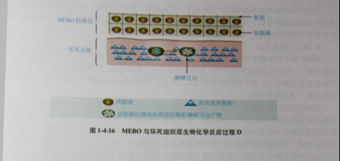 9170金沙集团_第三节 烧伤创面坏死组织液化扫除与实验要领
