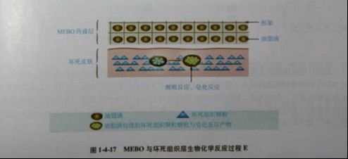 9170金沙集团_第三节 烧伤创面坏死组织液化扫除与实验要领