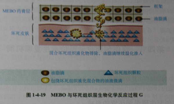 9170金沙集团_第三节 烧伤创面坏死组织液化扫除与实验要领