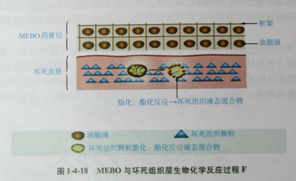 9170金沙集团_第三节 烧伤创面坏死组织液化扫除与实验要领