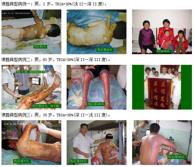 9170金沙集团_再生医学临床研究项目通过开封市科研效果判断