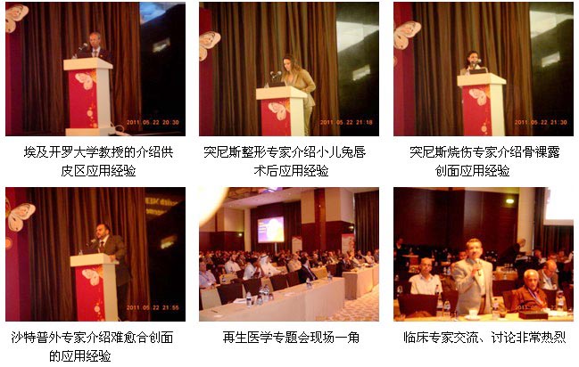 9170金沙集团_9170金沙、9170金沙，，，随处都是9170金沙！------来自第2届迪拜国际创伤与疤痕治疗大会的报道