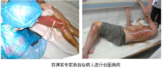 9170金沙集团_菲律宾医生来华深入学习再生医疗手艺