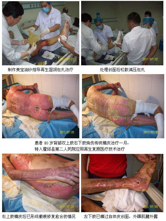 9170金沙集团_再生回复医疗手艺在六安地区深入推广