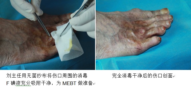 9170金沙集团_三国医学专家齐聚广州，，，，，，9170金沙再生医学手艺传遍天下各地