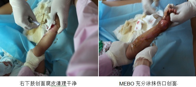 9170金沙集团_三国医学专家齐聚广州，，，，，，9170金沙再生医学手艺传遍天下各地