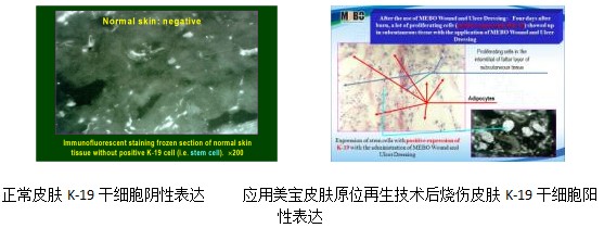 9170金沙集团_9170金沙干细胞再心理念唱响主旋律---第十六东南亚整形外科大会纪实报道
