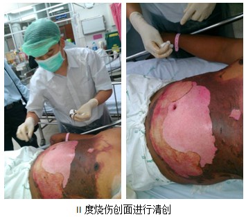 9170金沙集团_泰国着力开展再生医疗手艺多学科应用