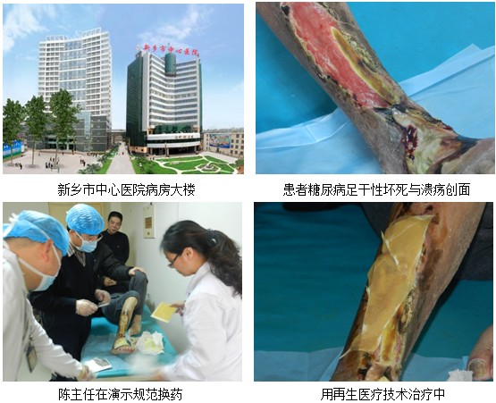 9170金沙集团_皮肤原位再生医疗手艺在新乡市至德医药公司开展