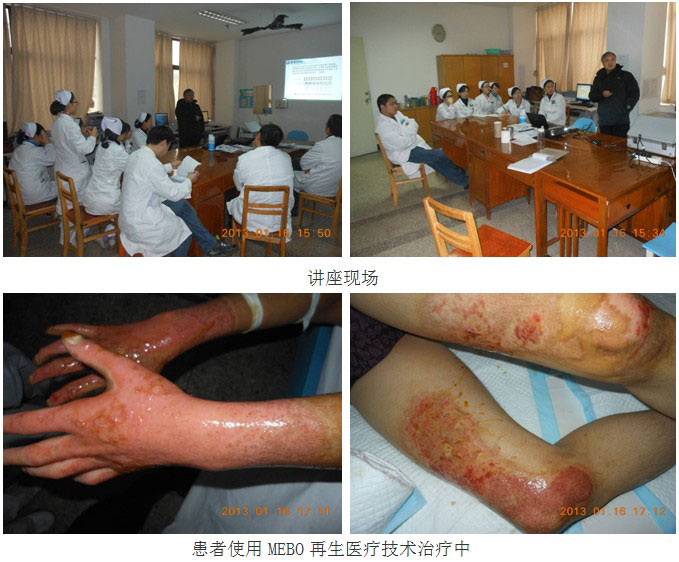 9170金沙集团_再生医疗手艺培训在湖北宜昌葛洲坝中心医院举行